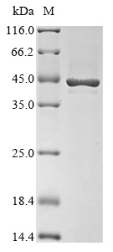 Recombinant Escherichia coli O157:H7 Cell division protein FtsZ (ftsZ)