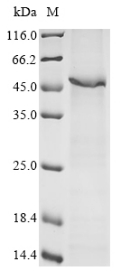 Recombinant Human Ribonuclease inhibitor (RNH1)