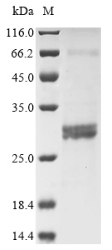 Recombinant Human Rho-related GTP-binding protein RhoG (RHOG)