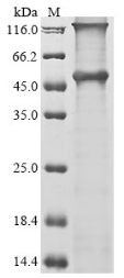 Recombinant Human Melanoma-associated antigen 12 (MAGEA12)