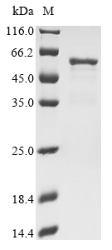 Recombinant Human Nucleosome assembly protein 1-like 4 (NAP1L4)