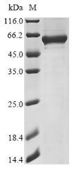 Recombinant Human SH2B adapter protein 1 (SH2B1) (T484A,V541A), partial