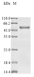 Recombinant Human UV excision repair protein RAD23 homolog A (RAD23A) (T131A)