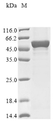 Recombinant Human Friend leukemia integration 1 transcription factor (FLI1)