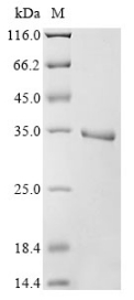 Recombinant Human Egl nine homolog 1 (EGLN1), partial