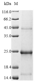 Recombinant Epstein-Barr virus Secreted protein BARF1 (BARF1)