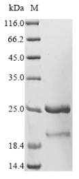 Recombinant Plasmodium falciparum L-lactate dehydrogenase, partial