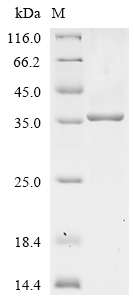 Recombinant Mouse Apolipoprotein E (Apoe)