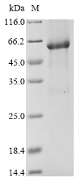 Recombinant Human Werner syndrome ATP-dependent helicase(WRN),partial