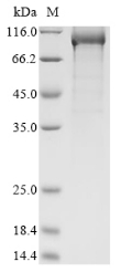 Recombinant Severe acute respiratory syndrome coronavirus 2 RNA-dependent RNA polymerase (NSP12)