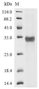 Recombinant Human Zinc finger protein GLI1 (GLI1), partial