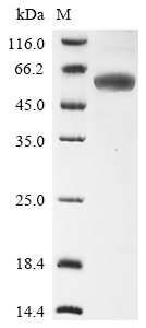 Recombinant Human Fructose-bisphosphate aldolase A (ALDOA)