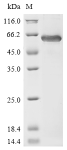 Recombinant Human Cartilage matrix protein (MATN1)
