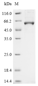 Recombinant Human Cytochrome P450 26B1 (CYP26B1)