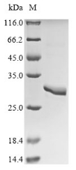 Recombinant Rat Asialoglycoprotein receptor 1 (Asgr1), partial