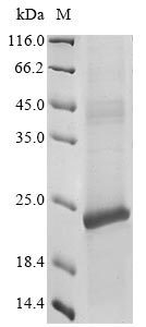 Recombinant Human Claudin-3 (CLDN3)