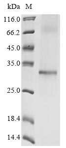 Recombinant Human Apolipoprotein L domain-containing protein 1 (APOLD1)