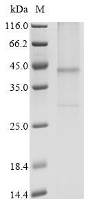 Recombinant Human Cysteinyl leukotriene receptor 1 (CYSLTR1)