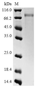 Recombinant Influenza A virus Hemagglutinin (HA), partial