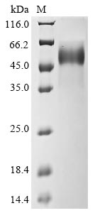 Recombinant Influenza A virus Hemagglutinin (HA), partial
