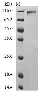 Recombinant Influenza A virus Hemagglutinin (HA), partial