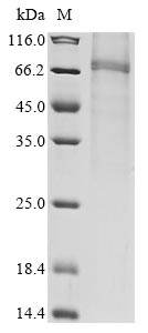 Recombinant Human Protein Wnt-4 (WNT4)