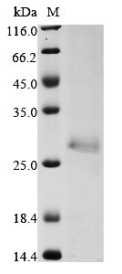 Recombinant Human E3 ubiquitin-protein ligase ZNRF3 (ZNRF3), partial