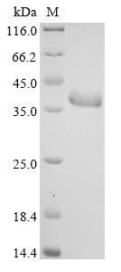 Recombinant Human Fructose-bisphosphate aldolase C (ALDOC)