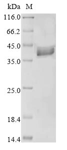 Recombinant Human Fructose-bisphosphate aldolase C(Aldoc)