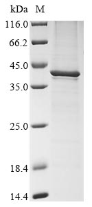 Recombinant Murine polyomavirus Major capsid protein VP1