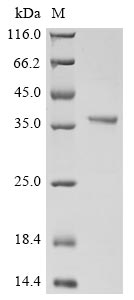 Recombinant Human Glutaminyl-peptide cyclotransferase (QPCT)