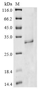 Recombinant Human Protein Wiz (WIZ), partial