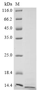 Recombinant Avian infectious bronchitis virus Non-structural protein 3b (3b)