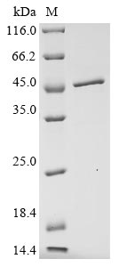 Recombinant Avian infectious bronchitis virus Nucleoprotein (N)