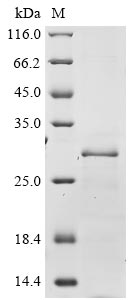 Recombinant Human Protein Wiz (WIZ), partial