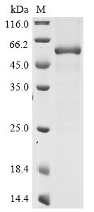 Recombinant Porphyromonas gingivalis Gingipain R2 (rgpB)