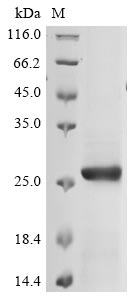 Recombinant Avian infectious bronchitis virus Spike glycoprotein (S), partial