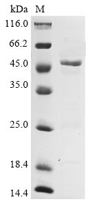 Recombinant Avian infectious bronchitis virus Nucleoprotein (N)