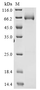 Recombinant Mouse High affinity cGMP-specific 3,5-cyclic phosphodiesterase 9A (Pde9a)