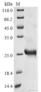 Recombinant Avian infectious bronchitis virus Spike glycoprotein (S), partial