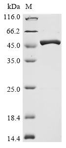 Recombinant Avian infectious bronchitis virus Nucleoprotein (N)