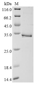 Recombinant Human Tryptase beta-2 (TPSB2)
