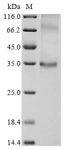 Recombinant Mouse Probable G-protein coupled receptor 146 (Gpr146)