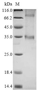 Recombinant Human Probable G-protein coupled receptor 146 (GPR146)