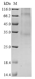 Recombinant Bovine Leukocyte antigen CD37 (CD37)