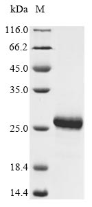 Recombinant Human Metalloproteinase inhibitor 2 (TIMP2)