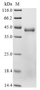 Recombinant Human Glutaminyl-peptide cyclotransferase (QPCT)