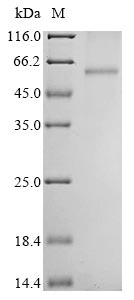 Recombinant Avian infectious bronchitis virus Nucleoprotein (N)