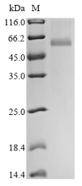 Recombinant Avian infectious bronchitis virus Nucleoprotein (N)