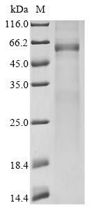 Recombinant Avian infectious bronchitis virus Nucleoprotein (N)